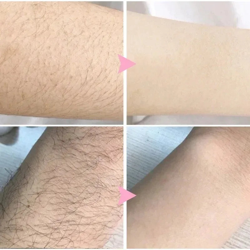 2 Minutes Quick Hair Removal Spray Painless Hair Growth Inhibitor Arms Arms Legs Permanent Hair Removal for Men Women 2025