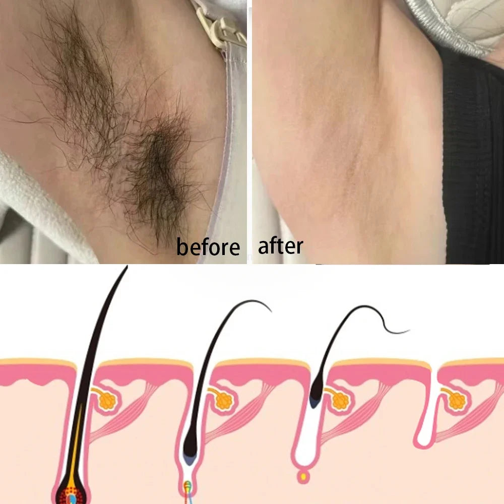 Fast Mild Hair Removal Cream Hair Growth Inhibitor Arm Armpit Leg Permanent Depilatory Moisturizing Beauty Smooth Body Skin Care