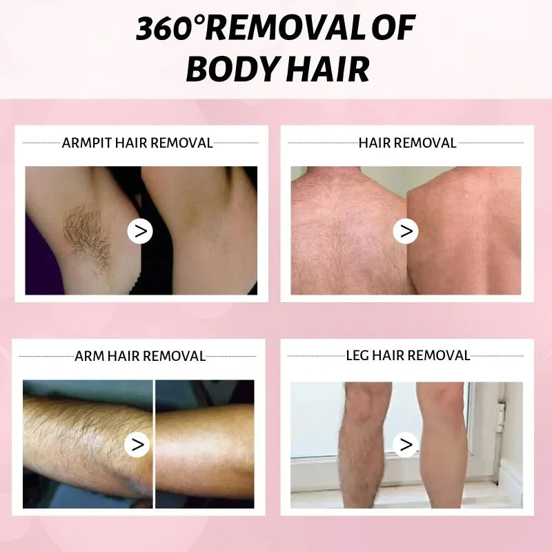 2 Minutes Quick Hair Removal Spray Painless Hair Growth Inhibitor Arms Arms Legs Permanent Hair Removal for Men Women 2025