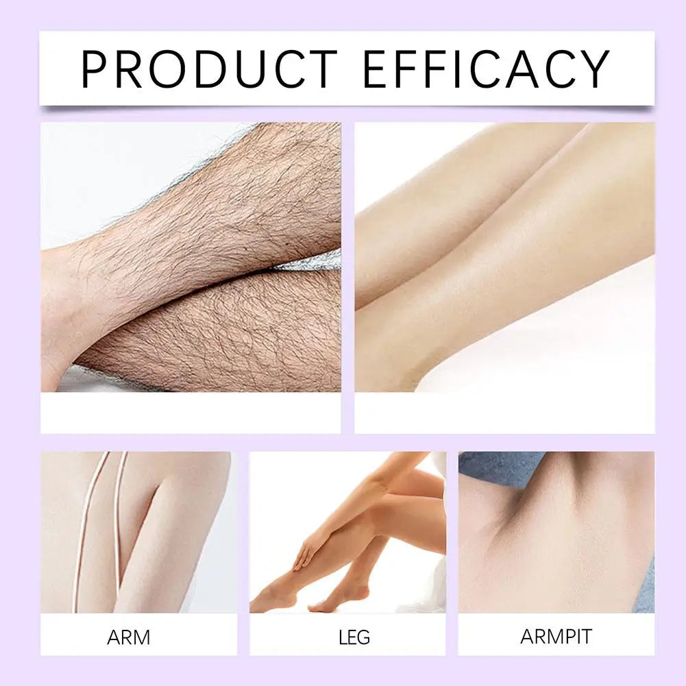 Hair removal cream eliminates hair on the legs arms and armpits Inhibitors prevent regeneration Gentle Body Hair Removal Cream